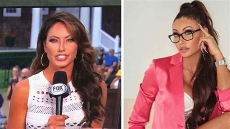 Holly Sonders’ Plastic Surgery Journey